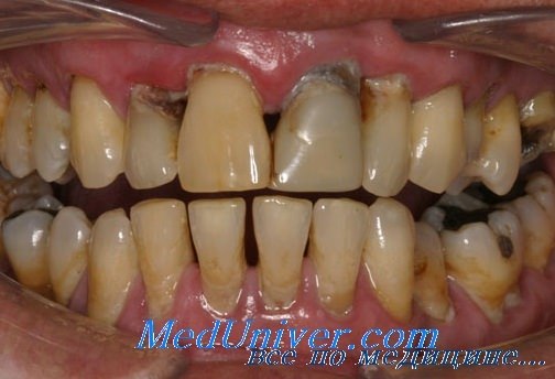 лечение в стоматологии