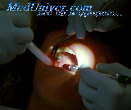лекарства в стоматологии