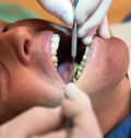 профилактика в стоматологии