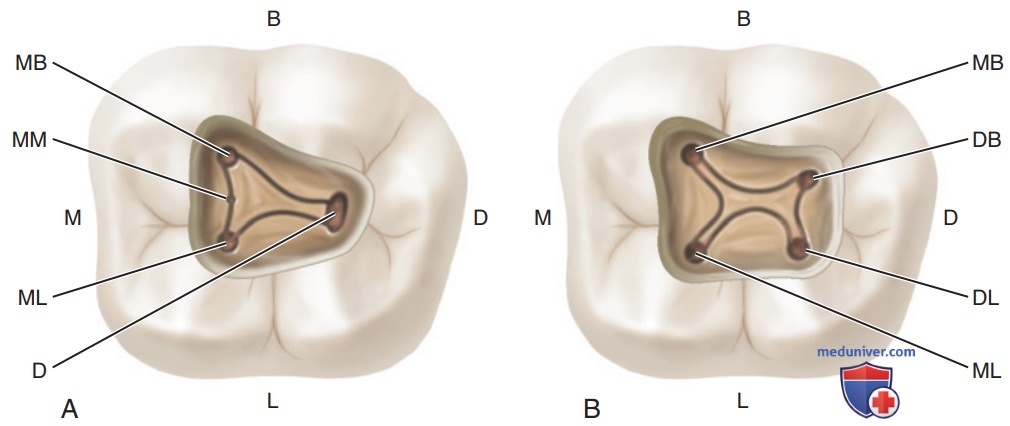 Название 4 канал. 2 Моляр верхней челюсти анатомия. Топография корневых каналов 16 зуба. 1 Моляр нижней челюсти анатомия корневых каналов. Первый Нижний моляр анатомия.