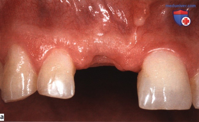 ������ ������ ������ ��� ����������� �������� �����