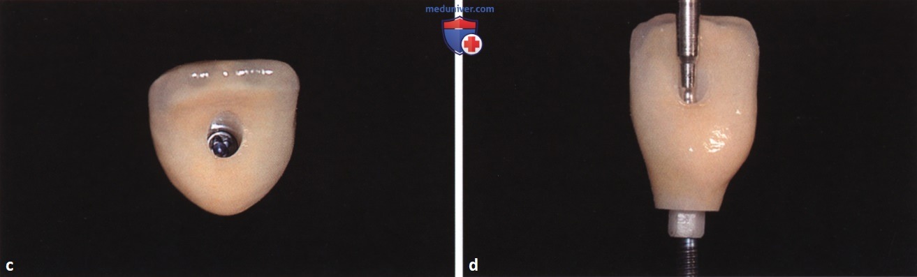 ��������� ��� �������� �������� ������� ��� ����������� � ������� �������� �����