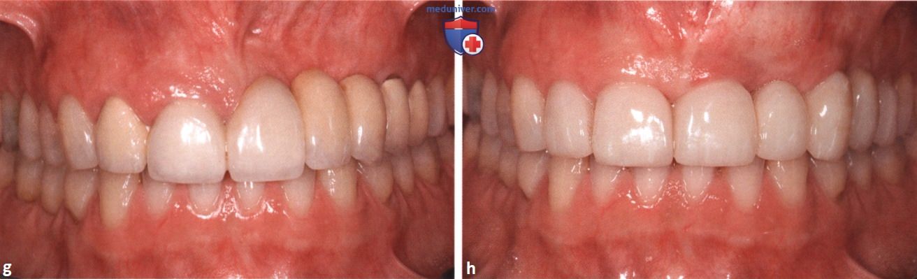������� ����������� ������ ��� ����������� � ������� �������� �����