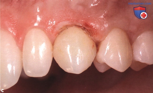 ������� ������ ������ � ������� ������� ��� ����������� � ������� �������� �����