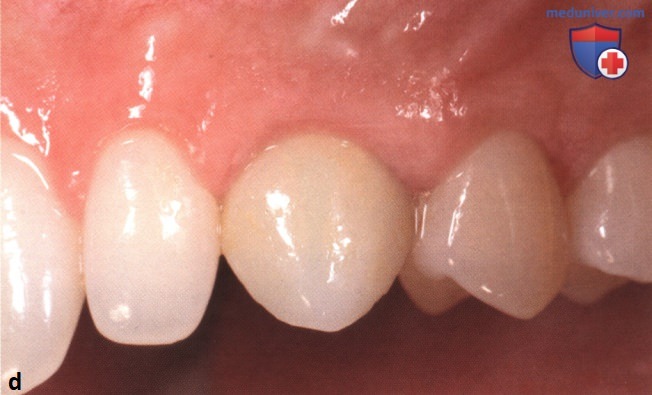 ������� ������ ������ � ������� ������� ��� ����������� � ������� �������� �����