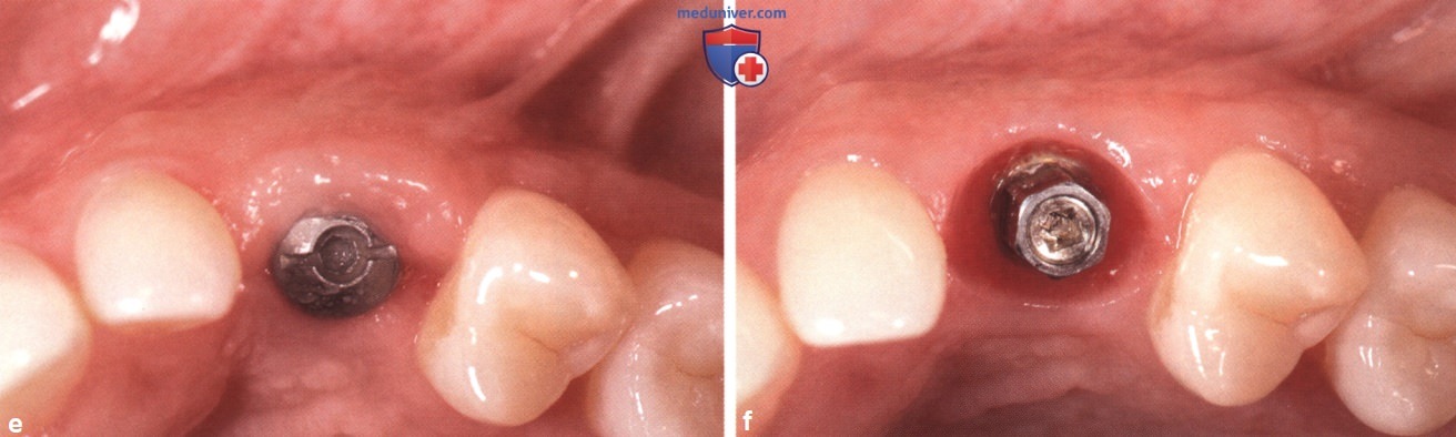 ������� ������ ������ � ������� ������� ��� ����������� � ������� �������� �����