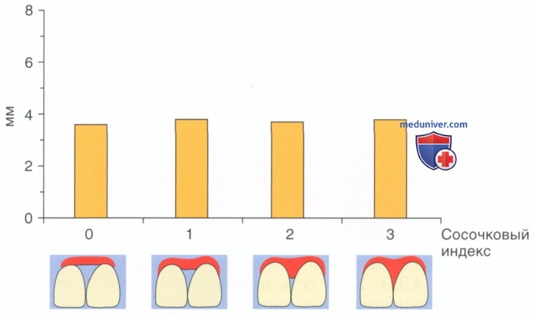 Размеры сосочков между зубами и имплантатами