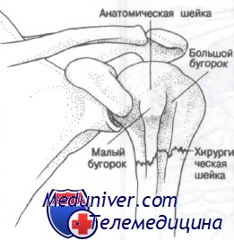 Внутрисуставные переломы проксимального конца плечевой кости thumbnail