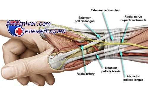 разрыв связок пальца руки лечение