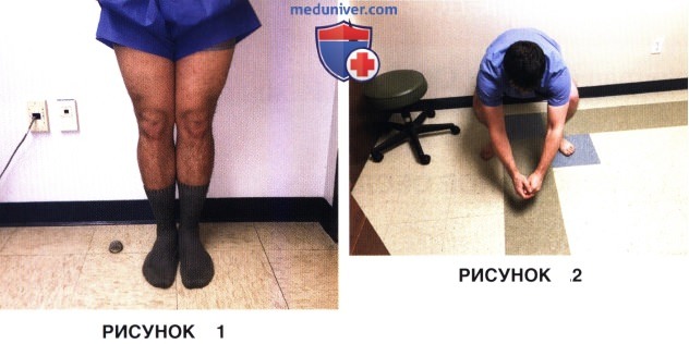 Сбор анамнеза и физикальное обследование при болезни коленного сустава