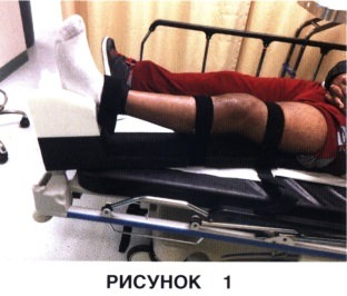 Показания и подготовка к артроскопическому артролизу коленного сустава