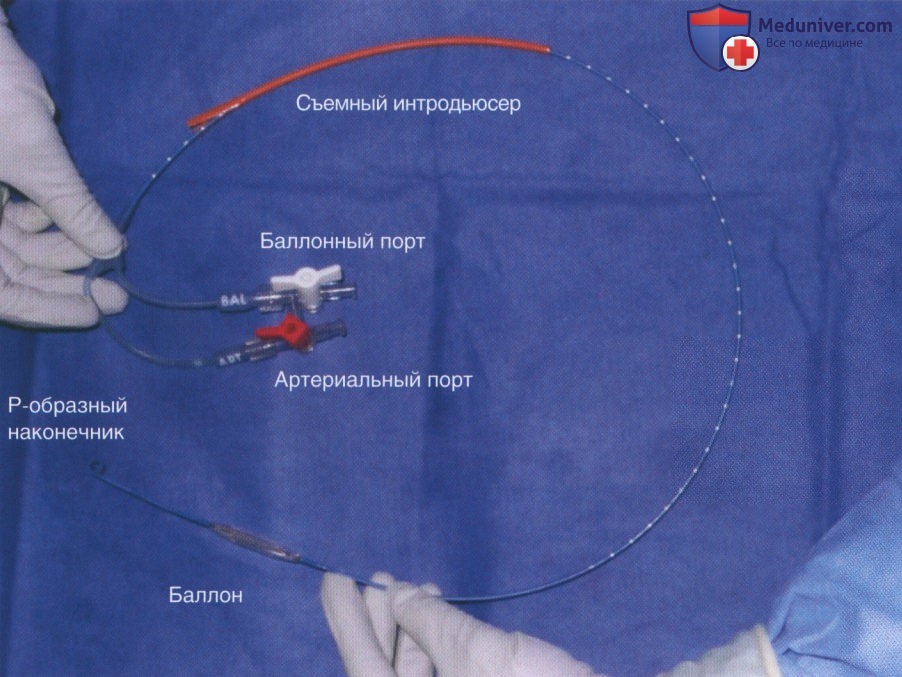 Техника, этапы реанимационной эндоваскулярной баллонной окклюзии аорты (РЭБОА)