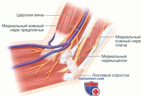 Операция кубитального канала. Локтевой нерв в кубитальном канале. Анатомия кубитального канала. Кубитальный канал локтевого нерва.