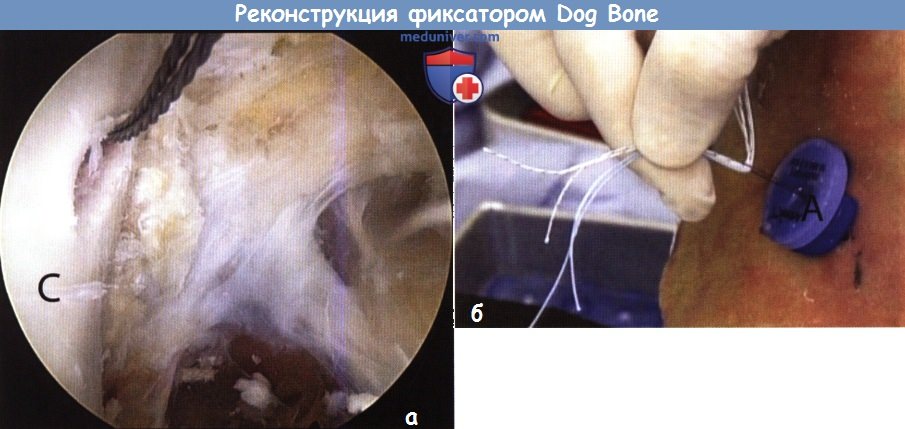      -     Dog Bone