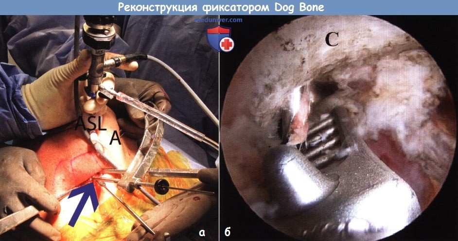      -     Dog Bone