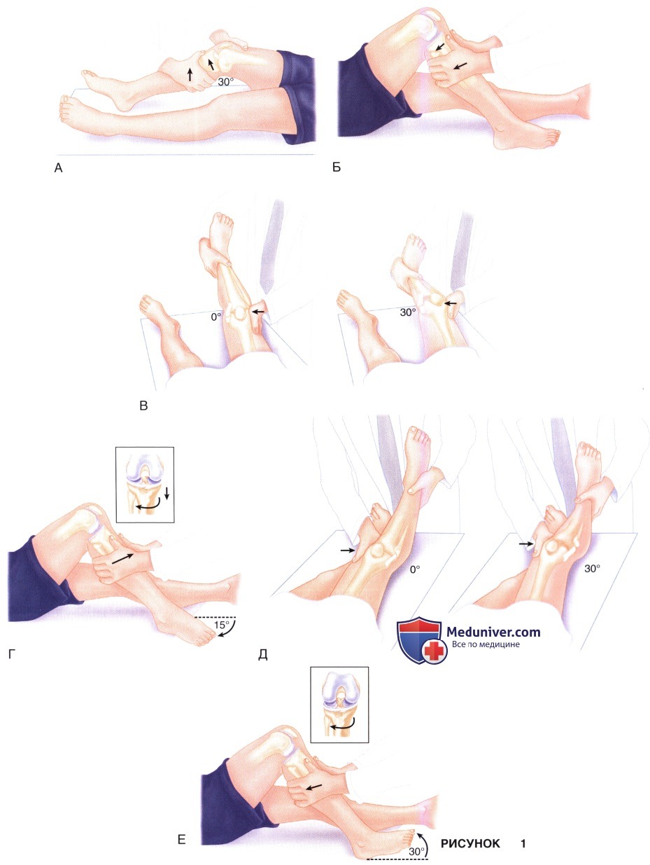 Показания, подготовка к мультисвязочным повреждениям коленного сустава