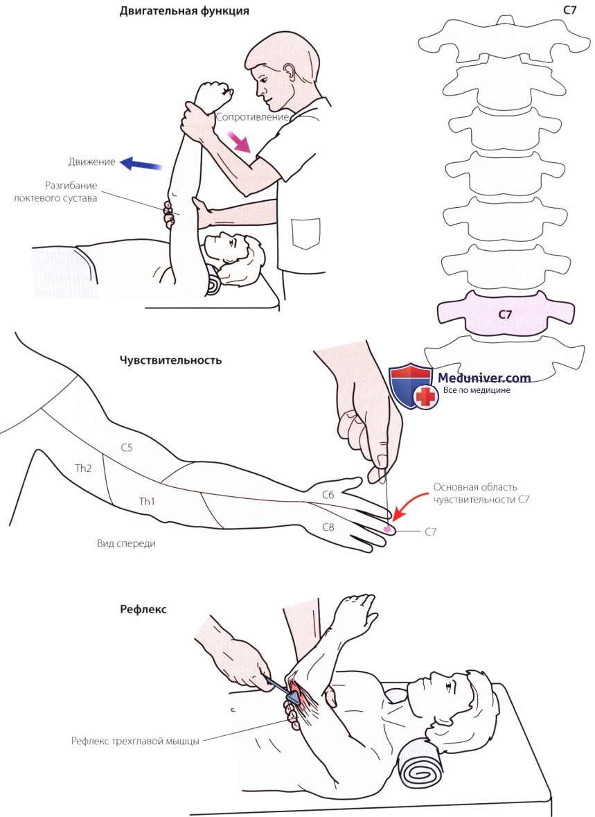 Неврологическое исследование шейного отдела позвоночника и верхней конечности (плечевого сплетения)