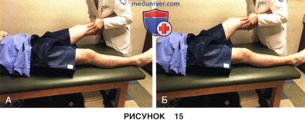 Оценка состояния связочного аппарата коленного сустава