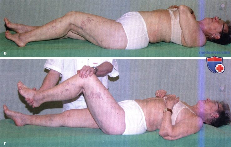 Первичный остеоартроз тазобедренного сустава