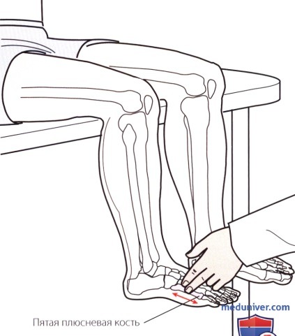 Пальпация голеностопного сустава и стопы снаружи (латеральной стороны)