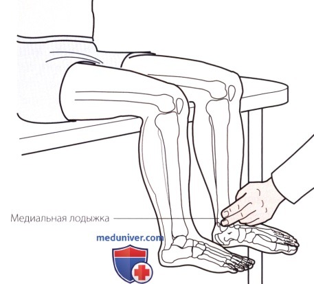 Пальпация голеностопного сустава и стопы с внутренней стороны (медиальной)
