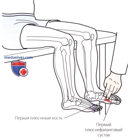 Пальпация голеностопного сустава и стопы с внутренней стороны (медиальной)