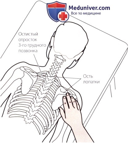 Пальпация костных структур шейного и грудного отделов позвоночника сзади