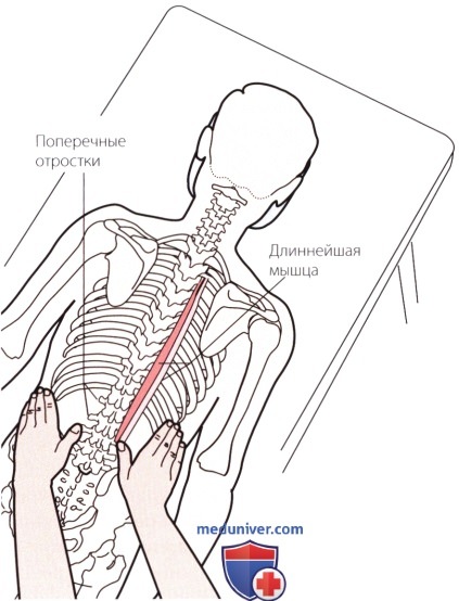 Пальпация костей пояснично-крестцового отдела позвоночника сзади