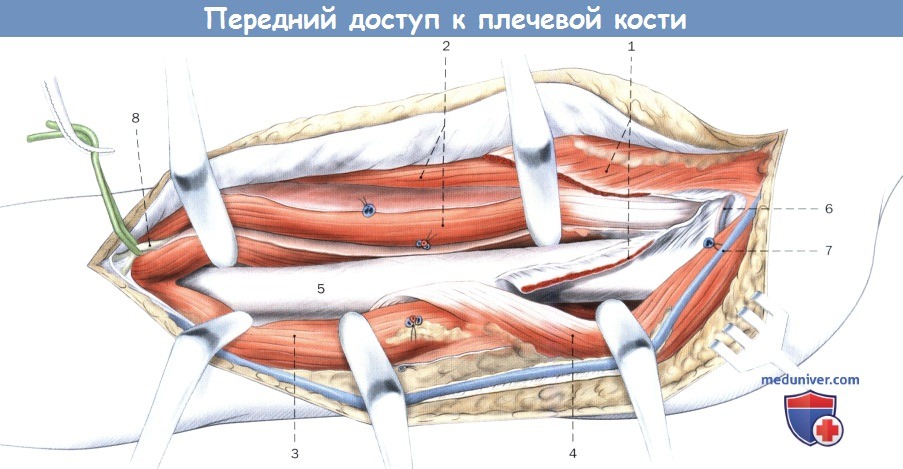Передний доступ к плечевой кости