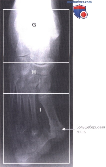 Примеры рентгенограмм голеностопного сустава и стопы