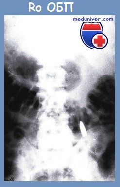 рентгенограмма органов брюшной полости