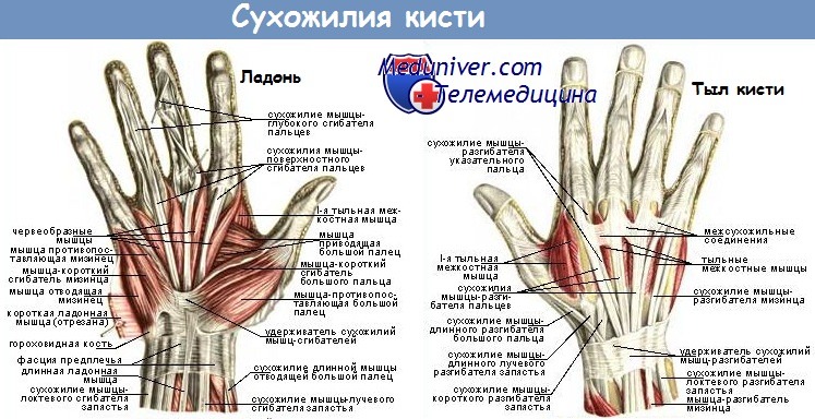 Hand Surgery Turkey - ТРАВМЫ СУХОЖИЛИЙ СГИБАТЕЛЕЙ ПАЛЬЦЕВ