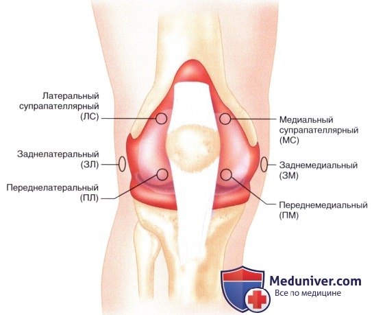 Доступ и техника артроскопической синовэктомии коленного сустава
