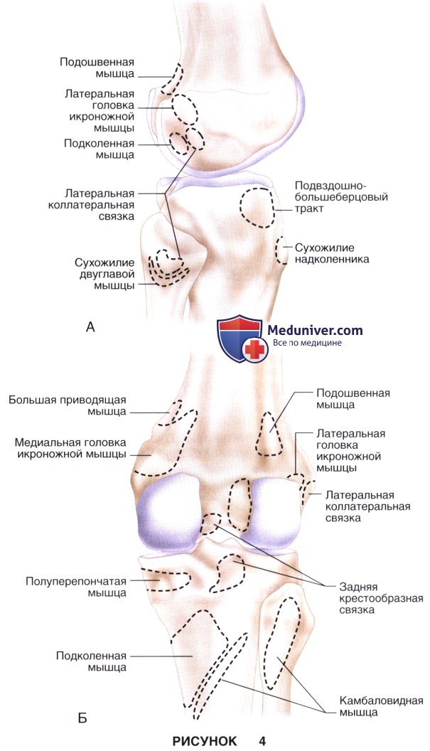 Показания, подготовка к тотальному эндопротезированию коленного сустава в условиях вальгусной деформации