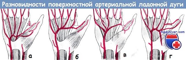 Варианты поверхностной артериальной ладонной дуги кисти