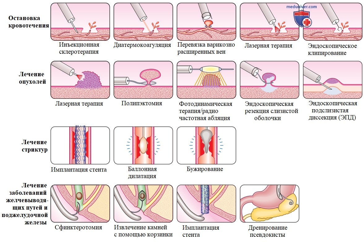 Методы обследования при болезнях желудочно-кишечного тракта (ЖКТ)