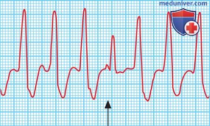 Отделение хирургического лечения нарушений ритма сердца